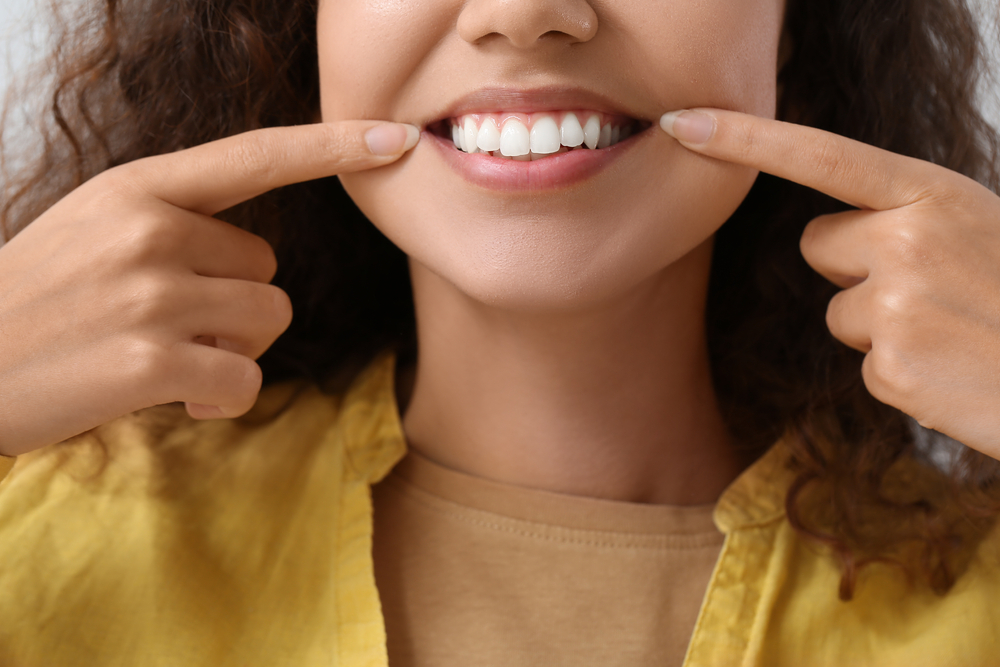 woman pointing at perfect smile after porcelain veneers